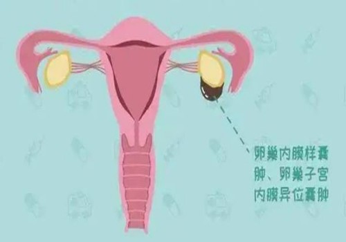 杭州试管代怀生子：﻿精子畸形率很难改善吗？常用的治疗方法有这几种