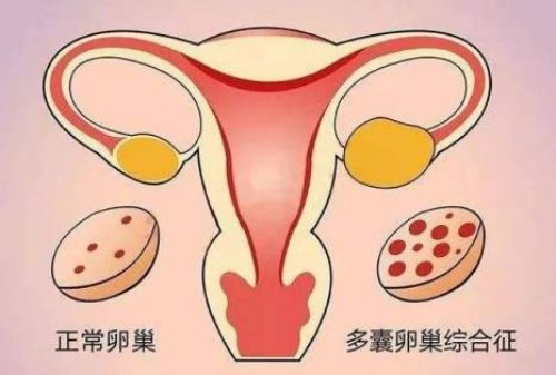 治疗不孕不育中药方剂，这些助孕偏方的效果具佳
