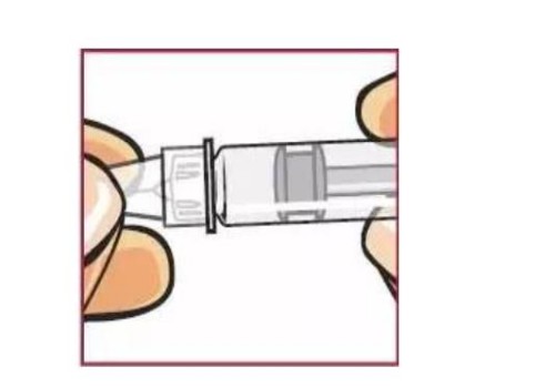 孕妇宫腔粘连要小心，严重可致胎儿停育